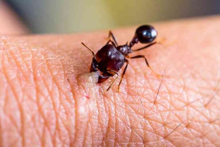 Guía para identificar picaduras de insectos y cuándo preocuparse