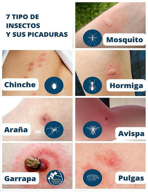 Comparación Visual: 8 Tipos De Picaduras De Insectos - Oliver Futur ...