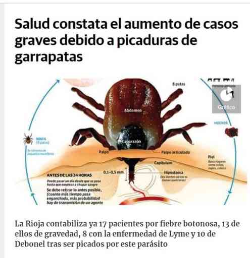 Tres Claves Para Identificar La Gravedad De Una Picadura De Insecto ...